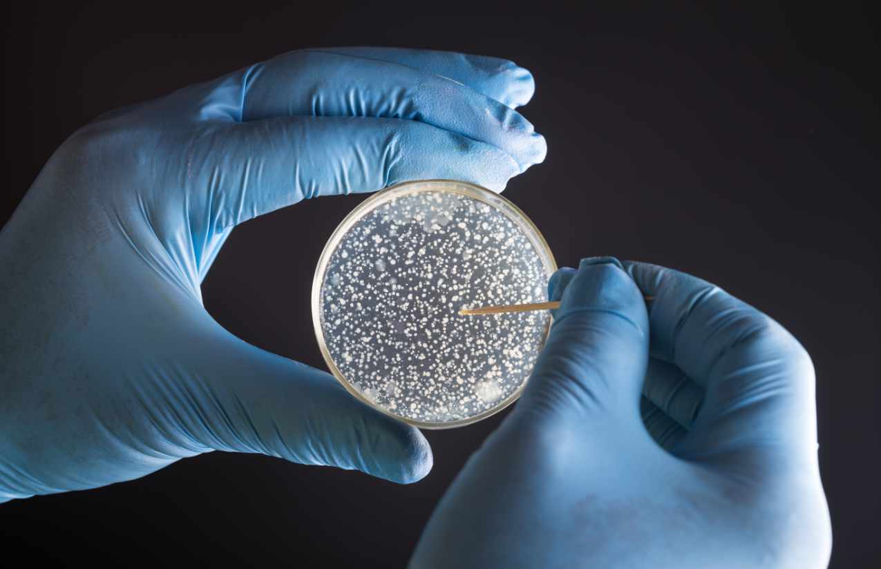 Was sind koloniebildende Einheiten bzw. die Gesamtkeimzahl?